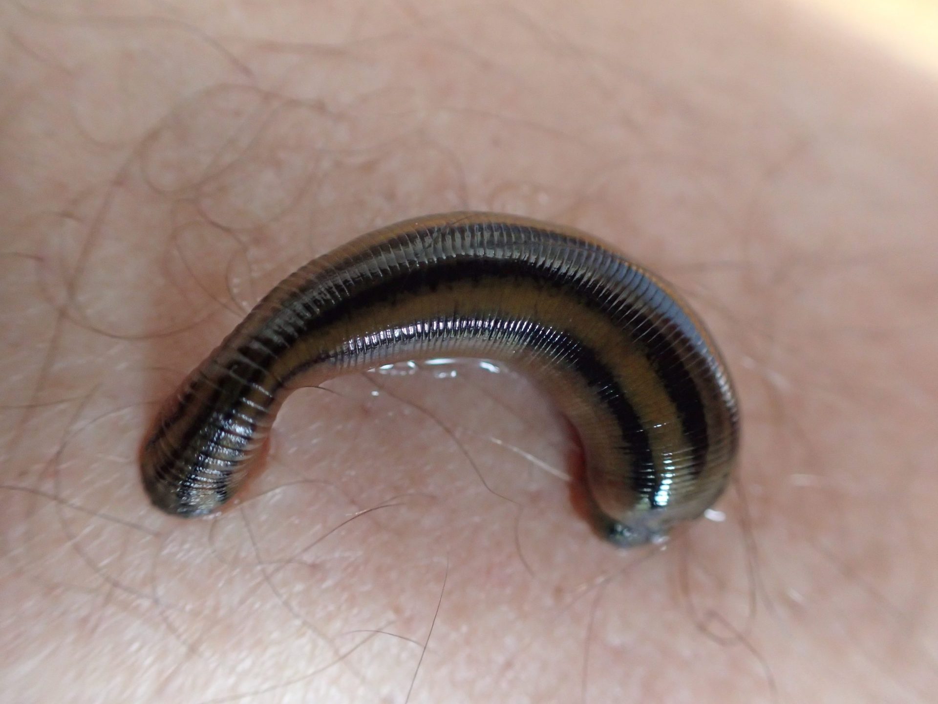 Leeches latch onto the Northern Beaches, but make the perfect pet