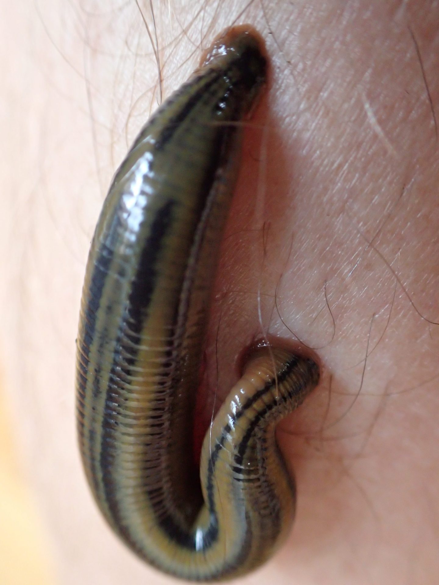 Leeches latch onto the Northern Beaches, but make the perfect pet - Manly  Observer